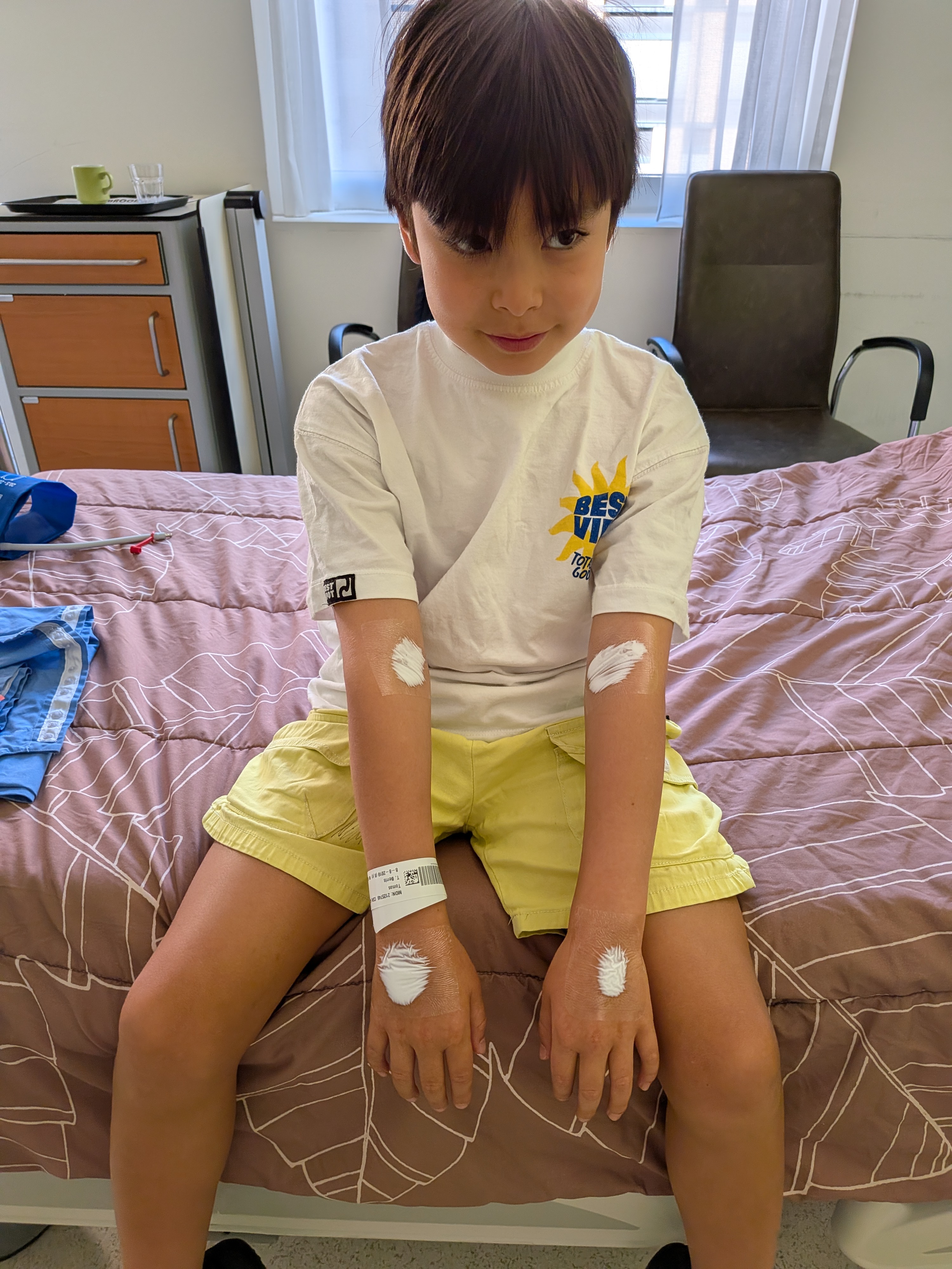 inguinal hernia operation Tomas photo 3